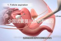 全國(guó)試管嬰兒成功率高的醫(yī)院有哪些?(全國(guó)試管嬰兒成功率高的醫(yī)院目錄一覽)