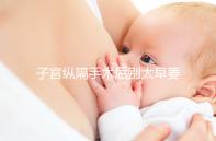 子宮縱隔手術后別太早要孩子,多久可以懷孕有時間要求!