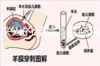 過來人的經(jīng)驗(yàn):囊胚移植第13天少量出血未必是壞事